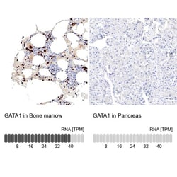GATA-1 Antibody, Novus Biologicals 0.1mL; Unlabeled:Antibodies, Polyclonal